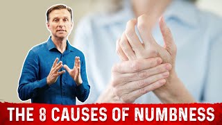 The 8 Causes of Numbness in the Body [upl. by Erminia]