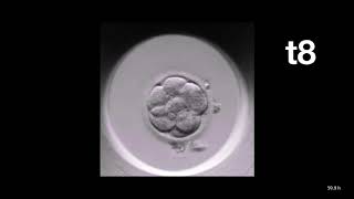 Amazing embryo development seen with EmbryoScope Gennima IVF [upl. by Hpesoy]