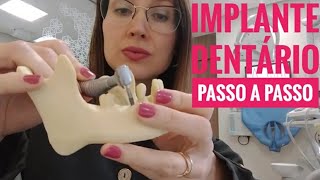 Implante Dentário Passo a Passo l Dra Danielle Sales [upl. by Moretta]