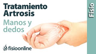 Tratamiento de fisioterapia para la artrosis de manos y dedos [upl. by Yelmene]