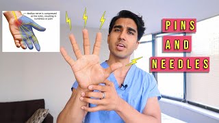 What Causes Pins and Needles in Hand at Night  Paresthesia [upl. by Adnilrev812]