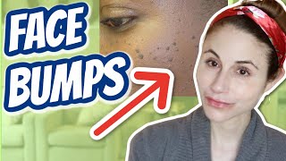 How to get rid of bumps on the face Dr Dray [upl. by Sergeant]