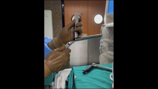 MLS microlaryngoscopy procedure [upl. by Nonnel]