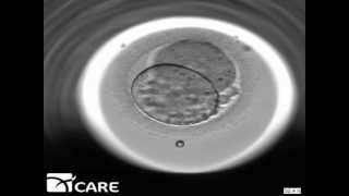 Time Lapse Embryo Imaging [upl. by Vladimir]