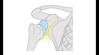 Strengthening Internal amp External Shoulder Rotators  Ask Dr Abelson [upl. by Missie]