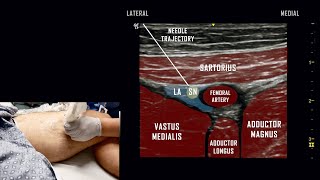 Adductor Canal Block  Ultrasound Anatomy Review [upl. by Airdnoed]