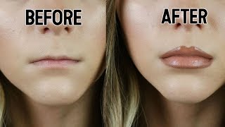 HOW TO FAKE LIP FILLERS  Noel Labb [upl. by Parhe660]