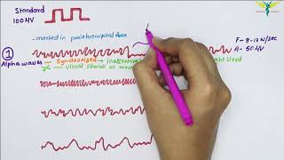 Electroencephalogram EEG  Waves  Physiology [upl. by Poppy]