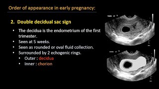 Ultrasound of normal early pregnancy [upl. by Nev]