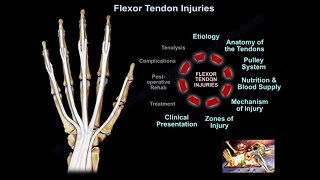 Flexor Tendon Injuries  Everything You Need To Know  Dr Nabil Ebraheim [upl. by Inram732]