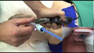 Direct amp Video Laryngoscopy [upl. by Hepsiba]