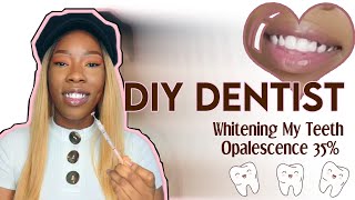 DIY DENTIST  Teeth Whitening using Opalescence 35 Gel [upl. by Nnylarak]