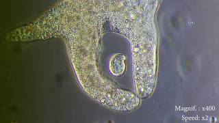 Amoeba eats paramecia  Amoebas lunch   Amoeba Endocytosis  Phagocytosis Part 1  👌 [upl. by Martinsen]