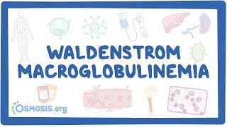 Diagnosing Waldenström Macroglobulinemia [upl. by Ody280]