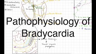 Artificial Pacemakers Tachycardia and Bradycardia  EKG Interpretation  LevelUpRN [upl. by Shamma]