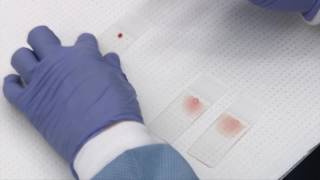 Making and staining blood smears [upl. by Terzas421]