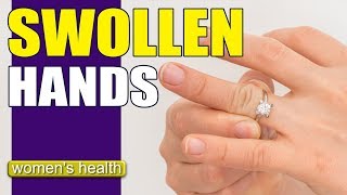 What Causes Swollen Hands  Reduce Swelling [upl. by Htor]