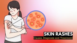 Skin Rash Causes Signs and Symptoms Diagnosis and Treatment [upl. by Annaj]