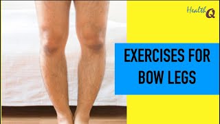 Easy Exercises for bow legs [upl. by Pengelly249]