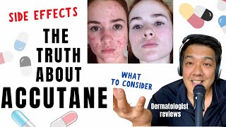 ACCUTANE  Dermatologist Review Unbiased [upl. by Susette867]