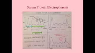 What is waldenstrom macroglobulinemia  Hematologic System Diseases  NCLEXRN  Khan Academy [upl. by Ahselaf898]