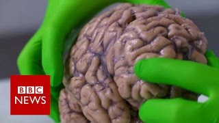 Anatomy of the Brain  Dissectible Model [upl. by Shane]