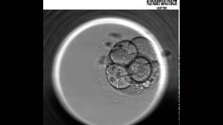 Embryoscope timelapse [upl. by Jen218]