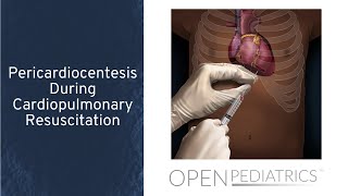 Managing Pulmonary Arterial Hypertension Therapeutic Selection and Care Coordination [upl. by Casimire]