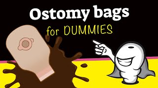 Ostomy bags for dummies [upl. by Aoh]