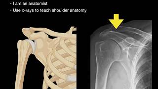 Anatomy of Shoulder Xrays [upl. by Zirkle]