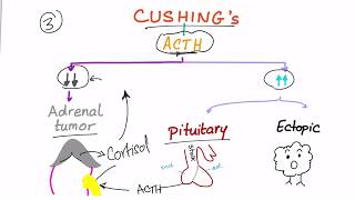 Cushing Syndrome Diagnostic Workup [upl. by Erfert]