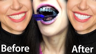 Fastest Way To Whiten Teeth At Home What REALLY Works [upl. by Schalles]