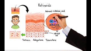 Pharmacology  ACNE TREATMENTS MADE EASY [upl. by Rockie]